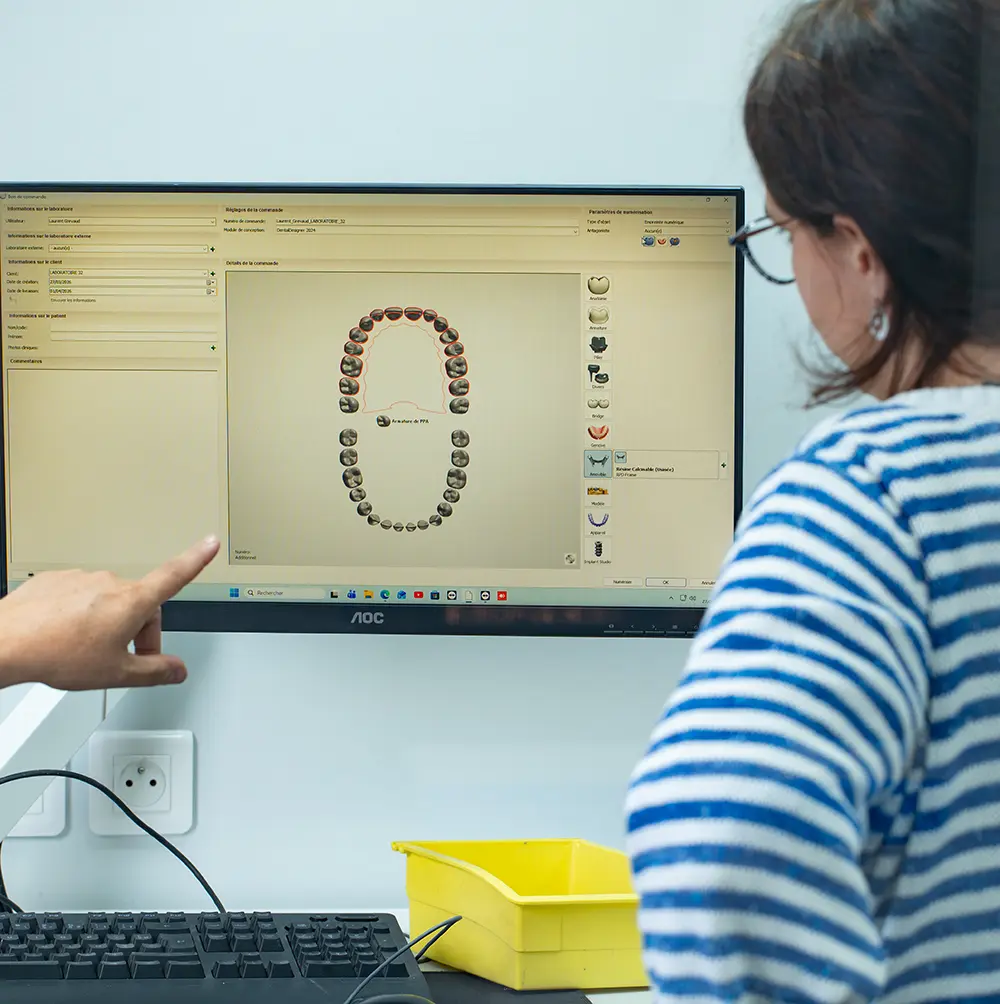 Modélisation numérique d'une arcade dentaire sur écran de conception CFAO 3D au Laboratoire 32.
