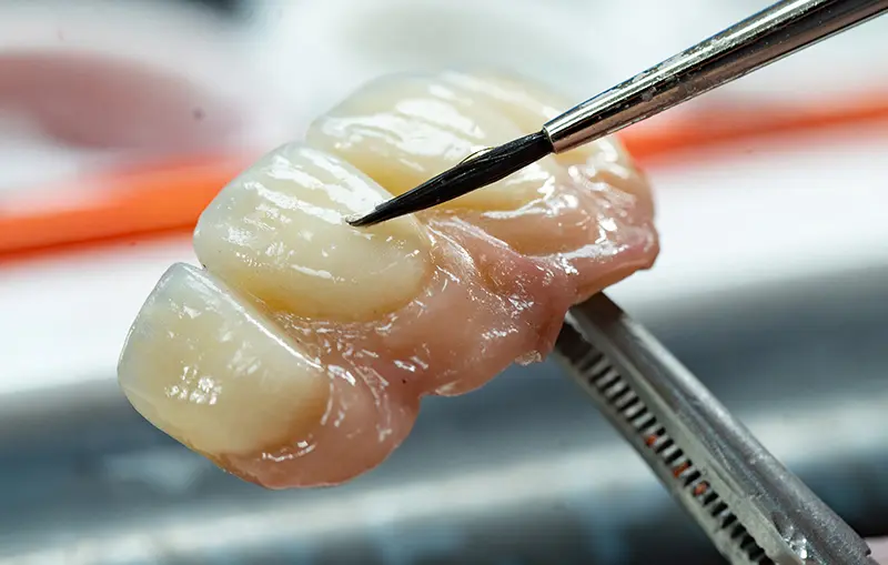 Gros plan sur la finition et le maquillage manuel d'une prothèse dentaire pour un rendu esthétique naturel.