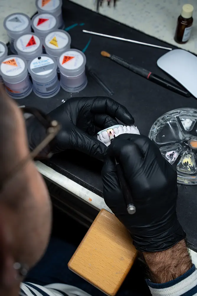 Artisan prothésiste dentaire assemblant avec minutie une solution prothétique sur mesure dans l'atelier du Laboratoire 32.